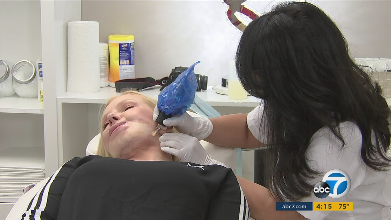 Tattoo technique helping patients with scars