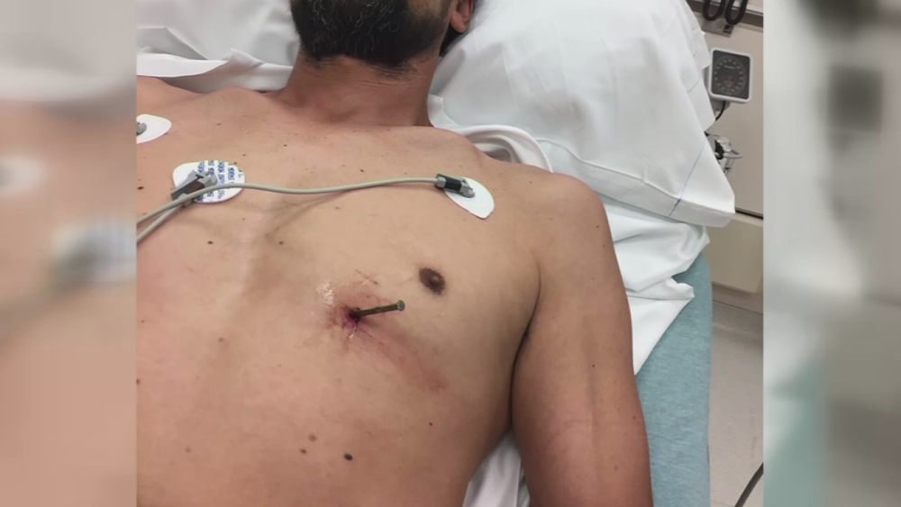 Man accidentally shoots nail into heart, drives to hospital