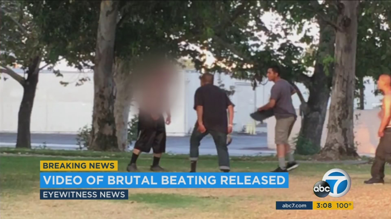 Santa Ana man beaten with skateboard, hammer by 2 suspects