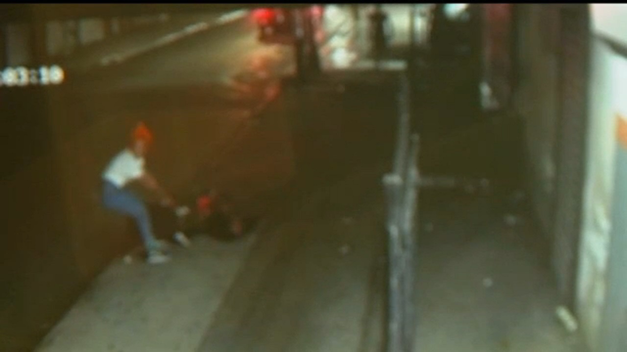 EXCLUSIVE: Queens dog attack victim speaks out