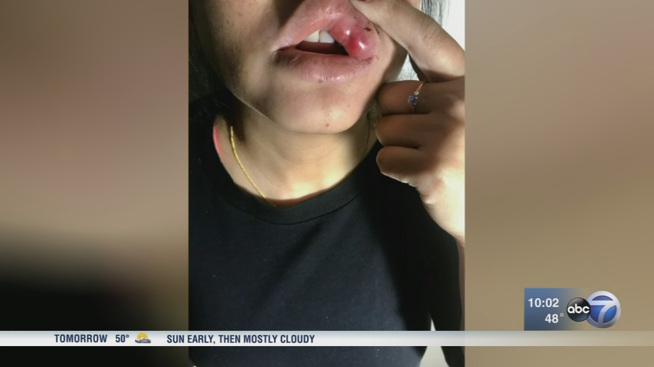 Sisters pistol-whipped during Chinatown robbery
