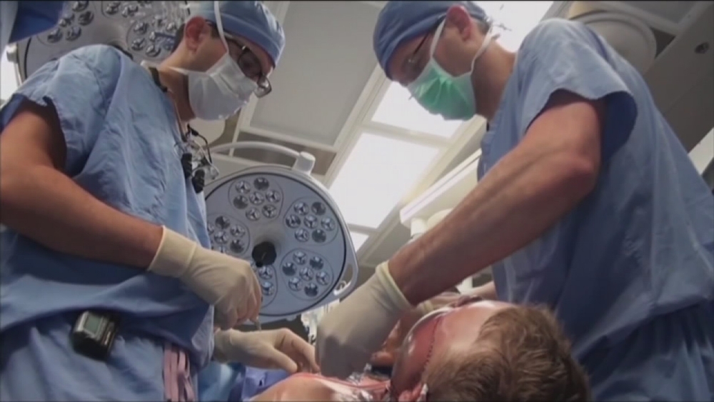 Woman meets transplant recipient of husband's face for first time