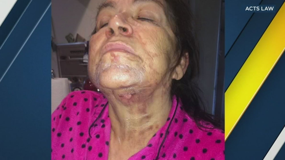 Latina superstar's mother claims 'Nutribullet' gave her serious injuries