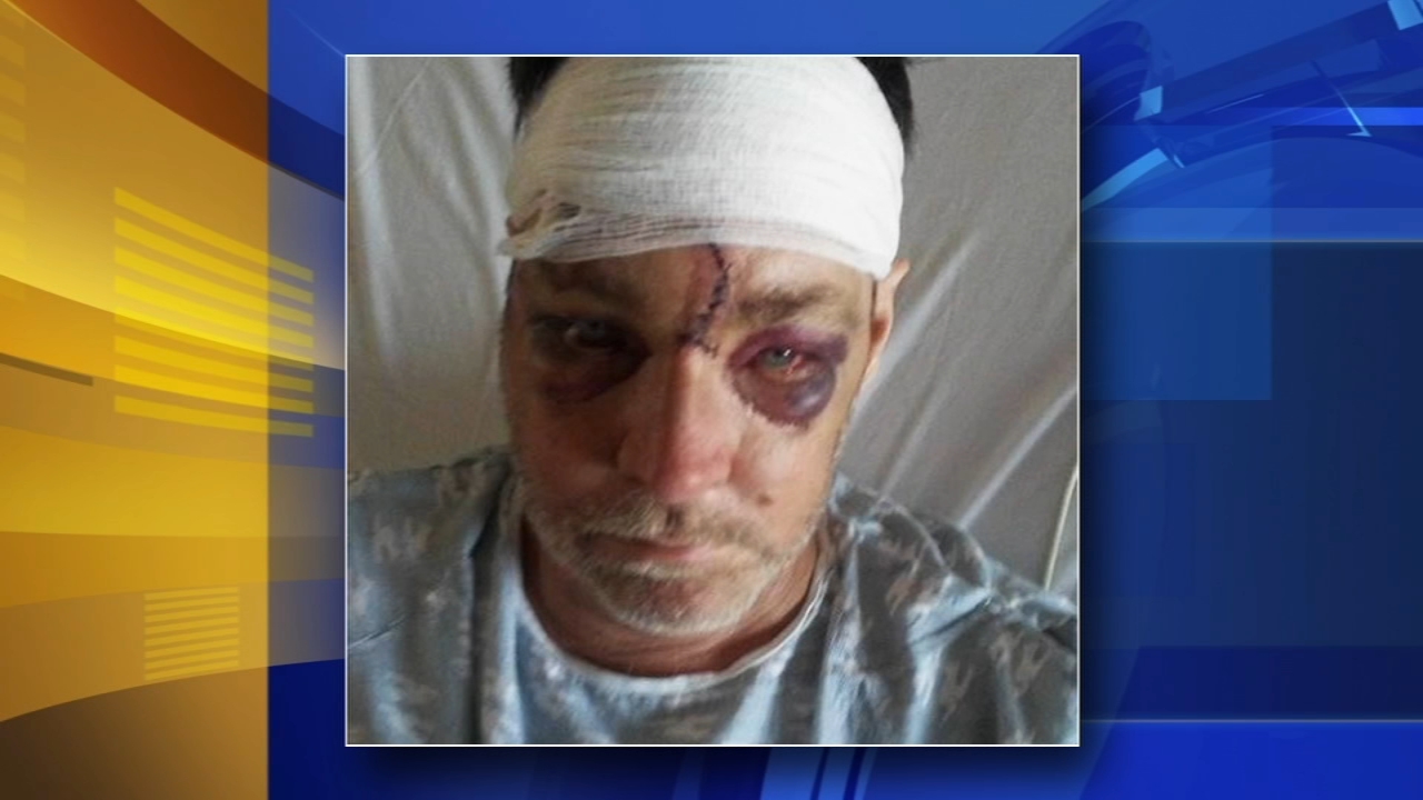 Good Samaritan shot in Kensington tells his story