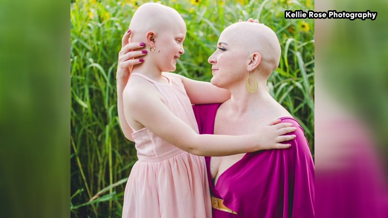 Mom and daughter prove bald is beautiful