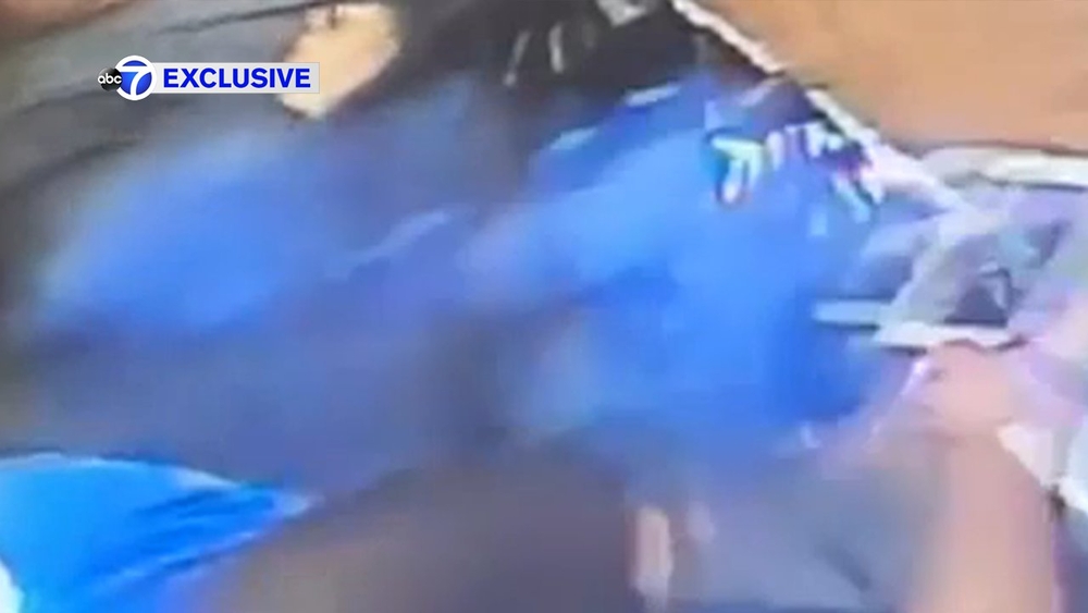 EXCLUSIVE: NYC man says iPhone 6 exploded in his hands