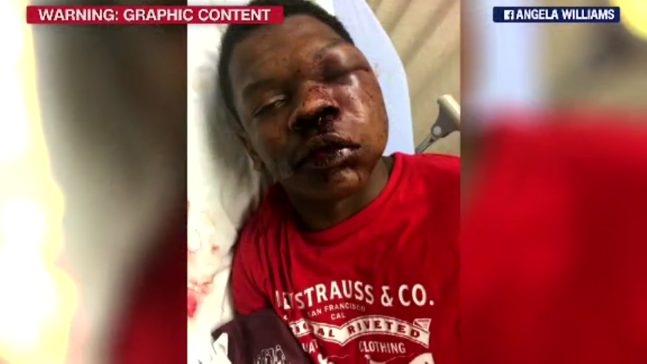 Rally held for teen beaten by police
