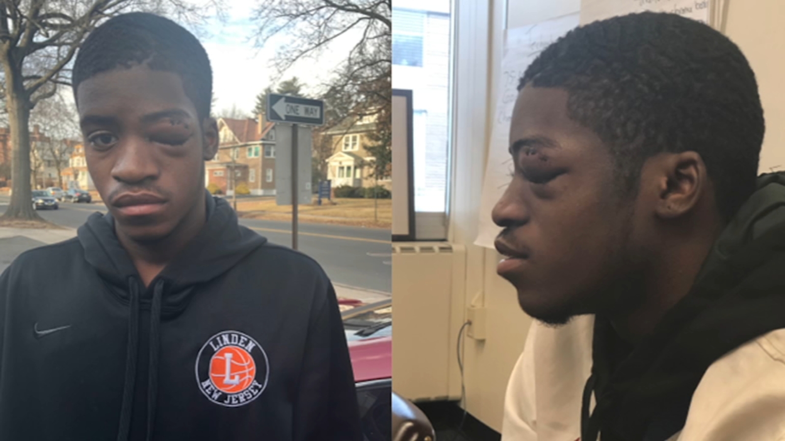 Linden High School basketball player punched during postgame handshake