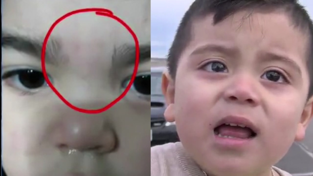 Moms upset, say daycare worker waxed their kids' unibrows