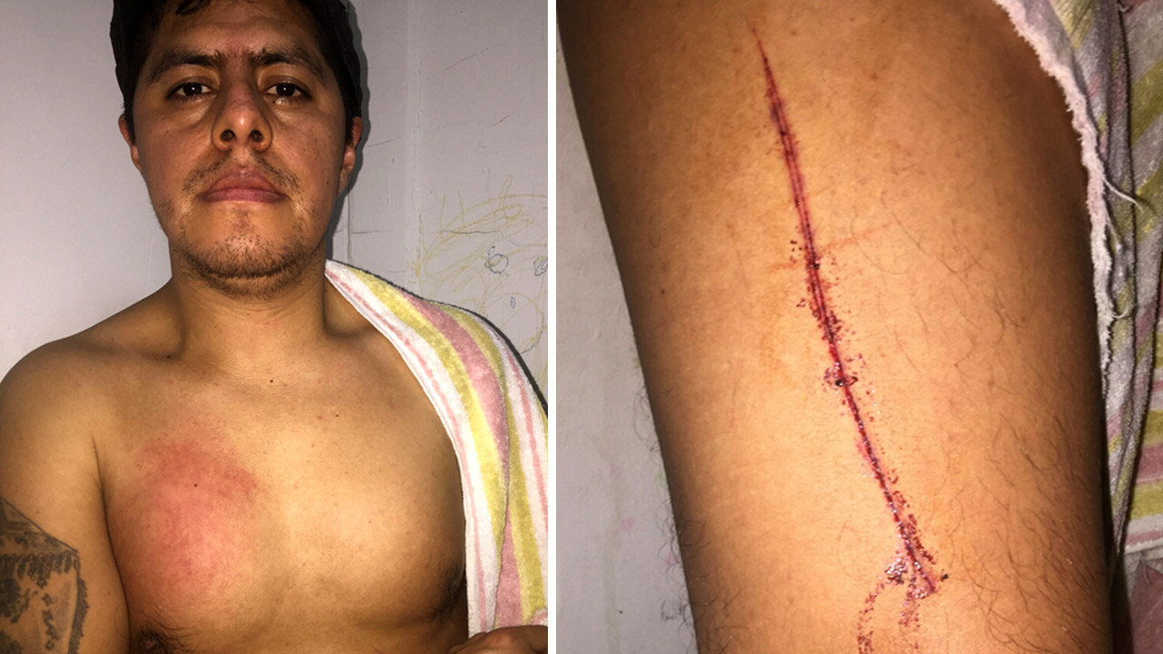Father attacked by hate-spewing man in Manhattan