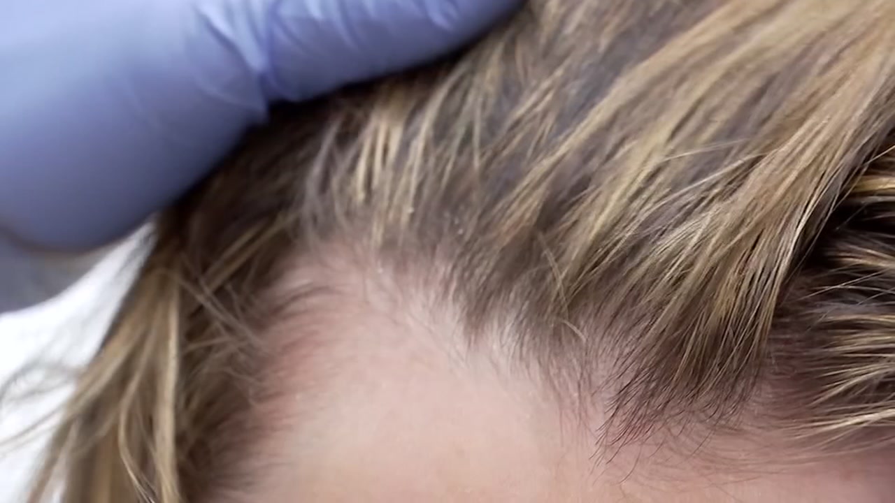 Sick of shampooing and blow-drying? Consider this hair craze