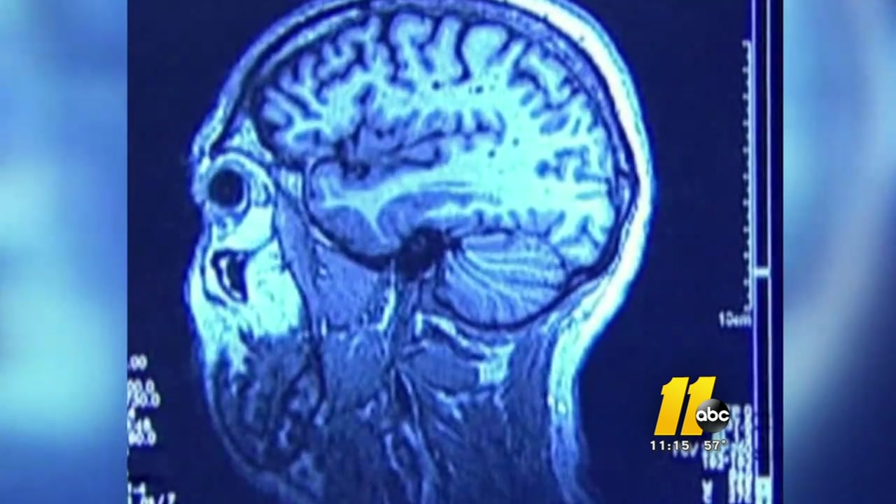 Documentary tackles troubling issue of CTE in football