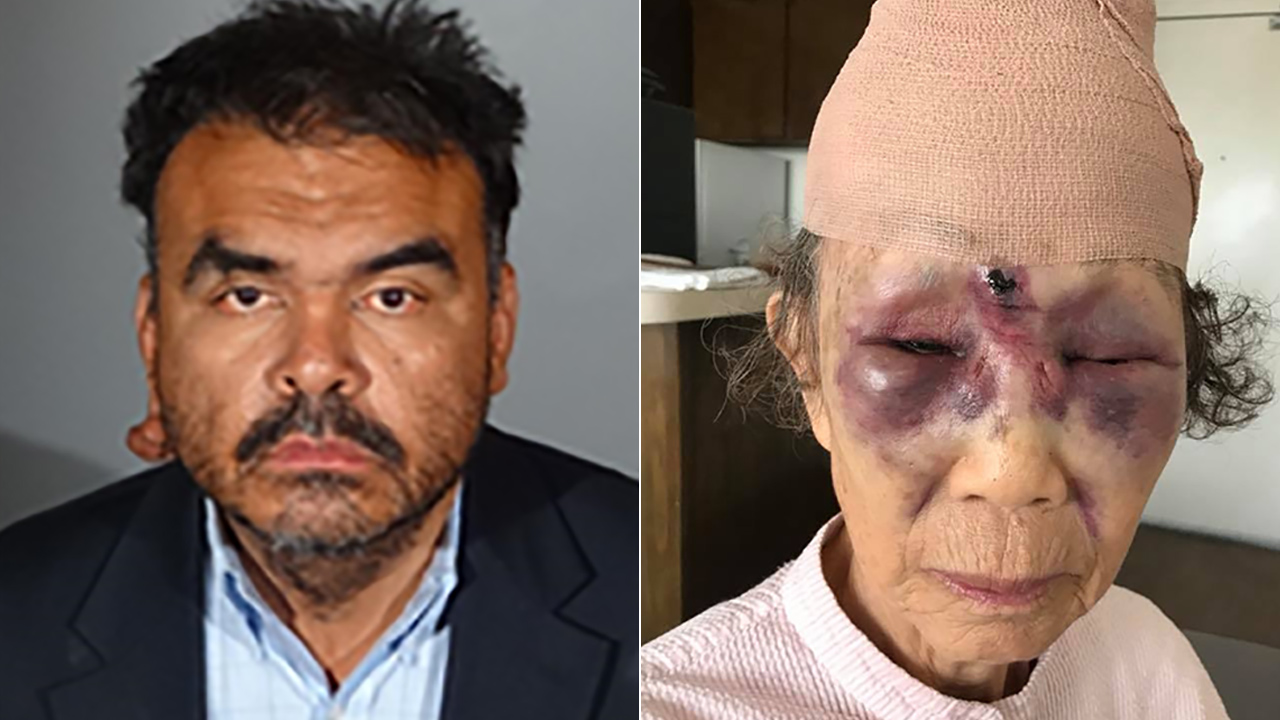 Koreatown beating: Suspect re-arrested in attack on grandmother