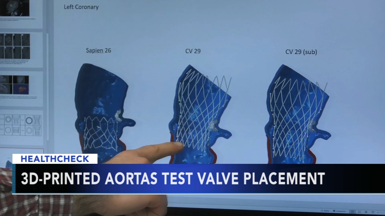 Experts testing 3D printers use to improve artificial valve placement