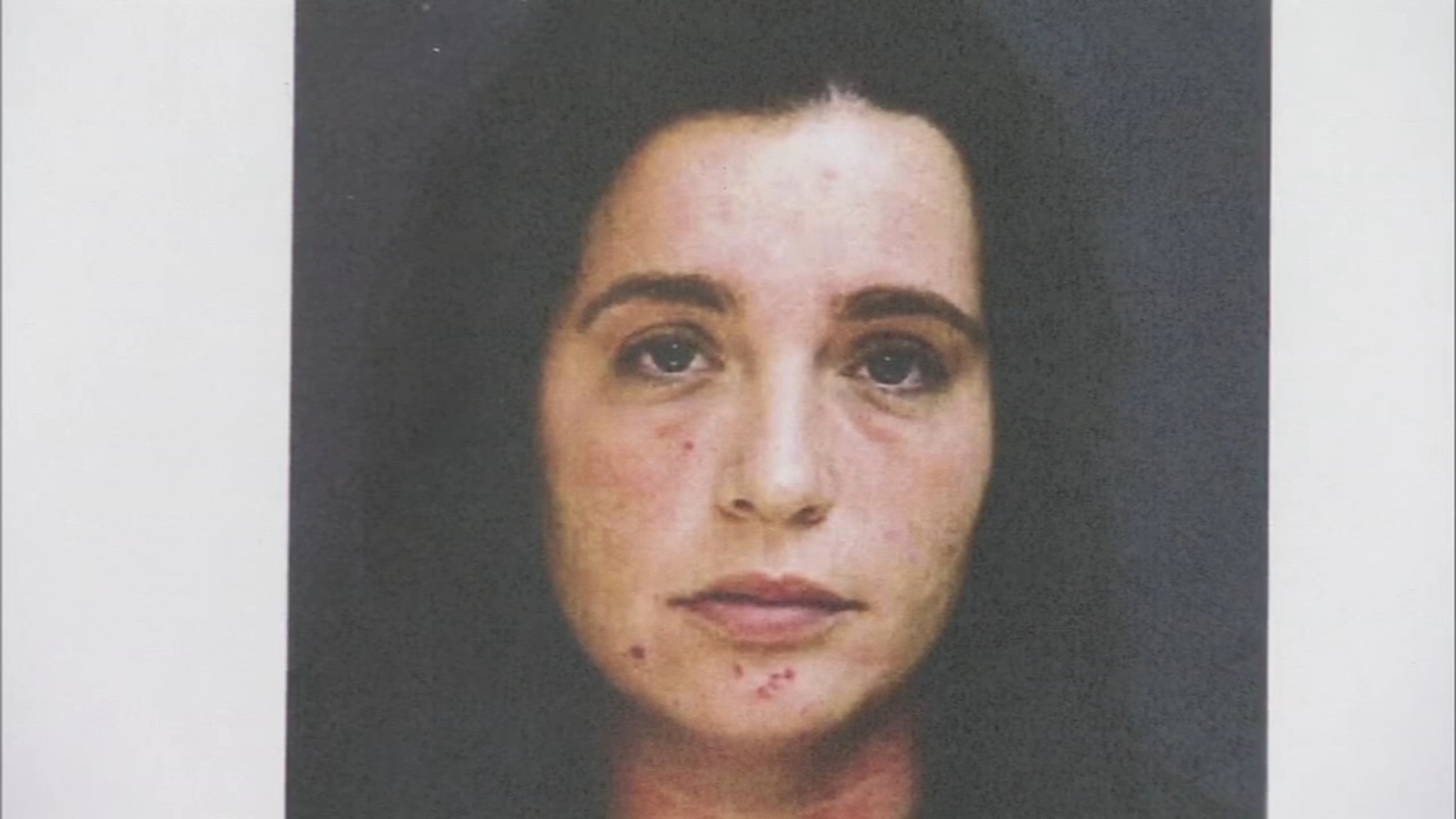 Home Health Care Worker Overdoses Saved By Patient Upper Darby Police