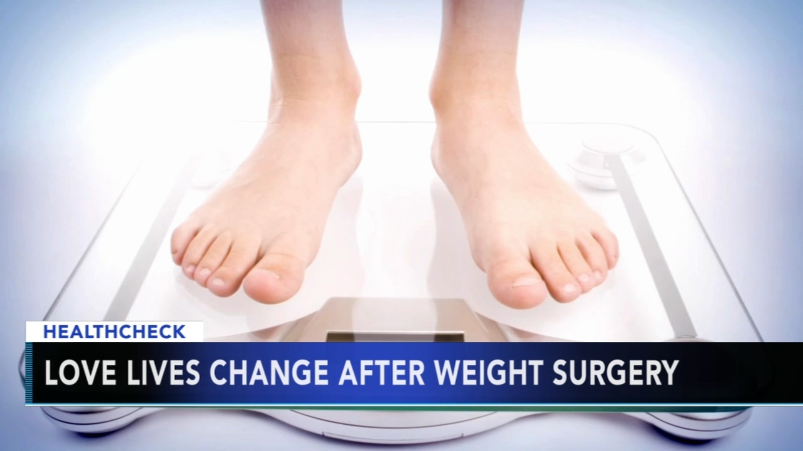 Weight loss surgery can change future relationships and love life