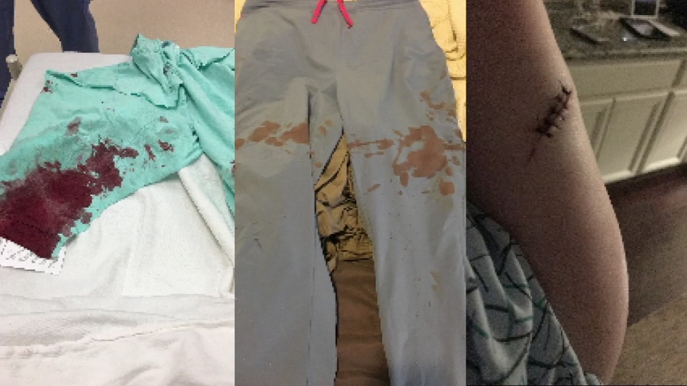 Muslim woman attacked