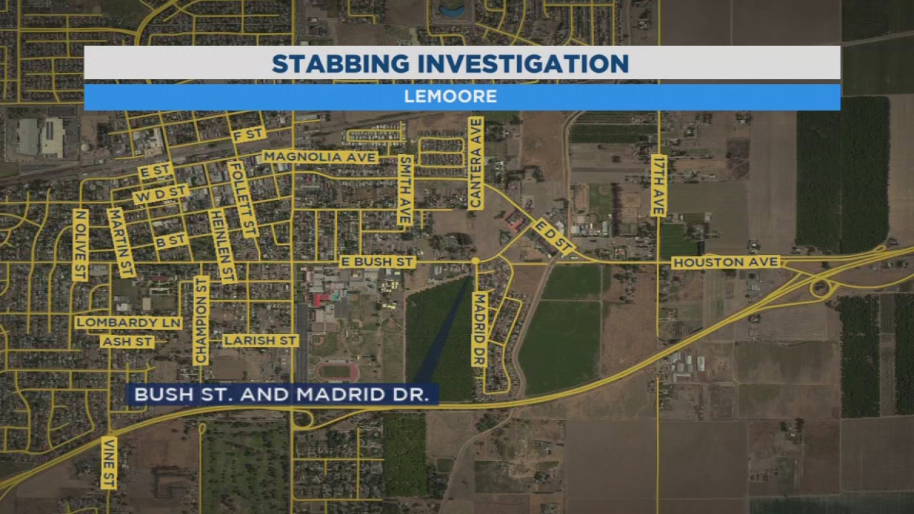 Man stabs girlfriend while driving, Lemoore Police say