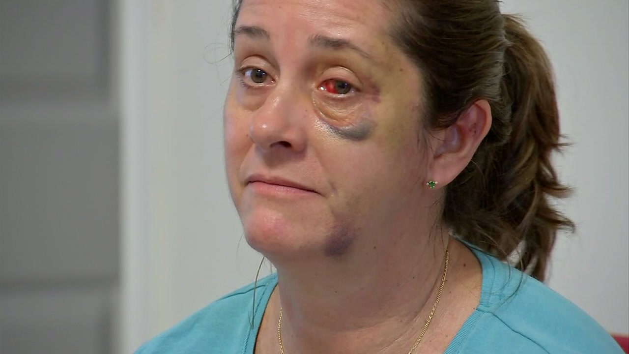 'I was happy': Kidnapping victim says she's relieved 22-year-old attack suspect is behind bars