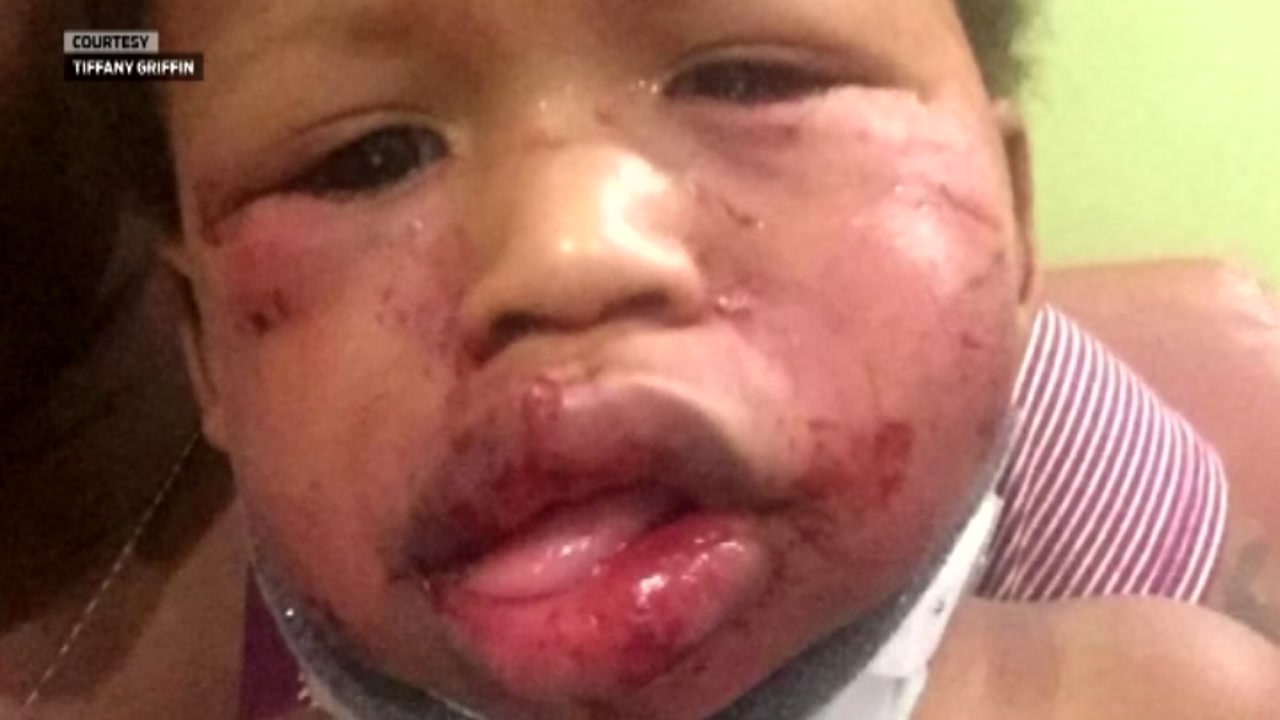 Day care where toddler was beaten has been ordered closed
