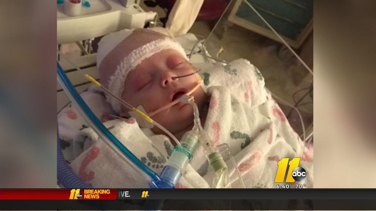 Iowa baby struck by softball may have suffered brain damage ABC13 Houston
