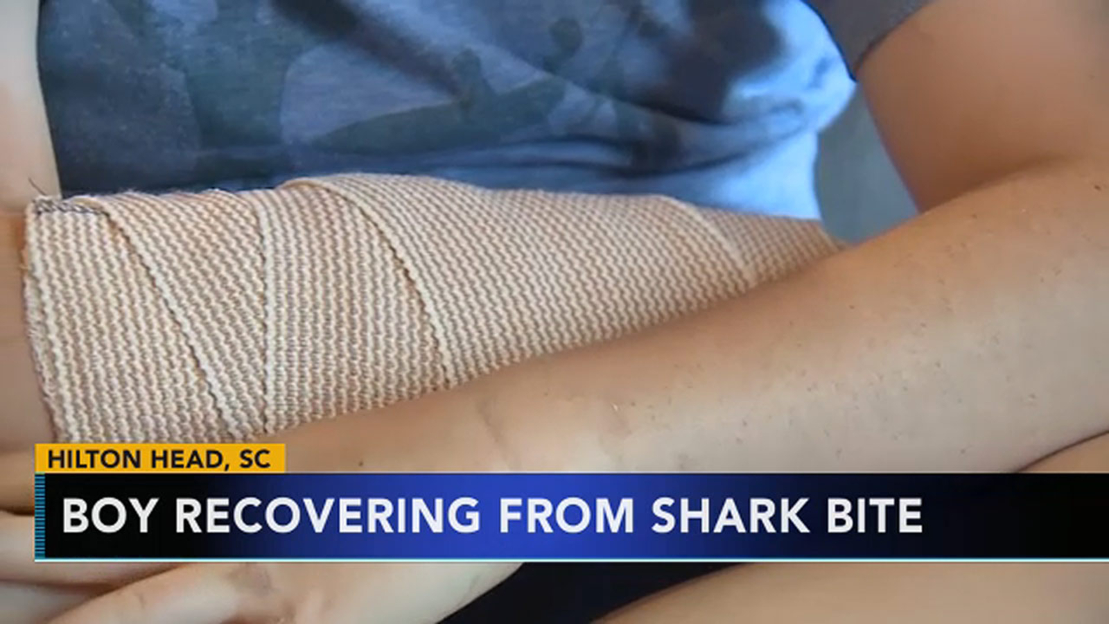 South Carolina boy recovers from shark bite 6abc Philadelphia