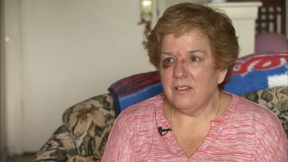 Phillies fan injured by Phanatic's flying hot dog