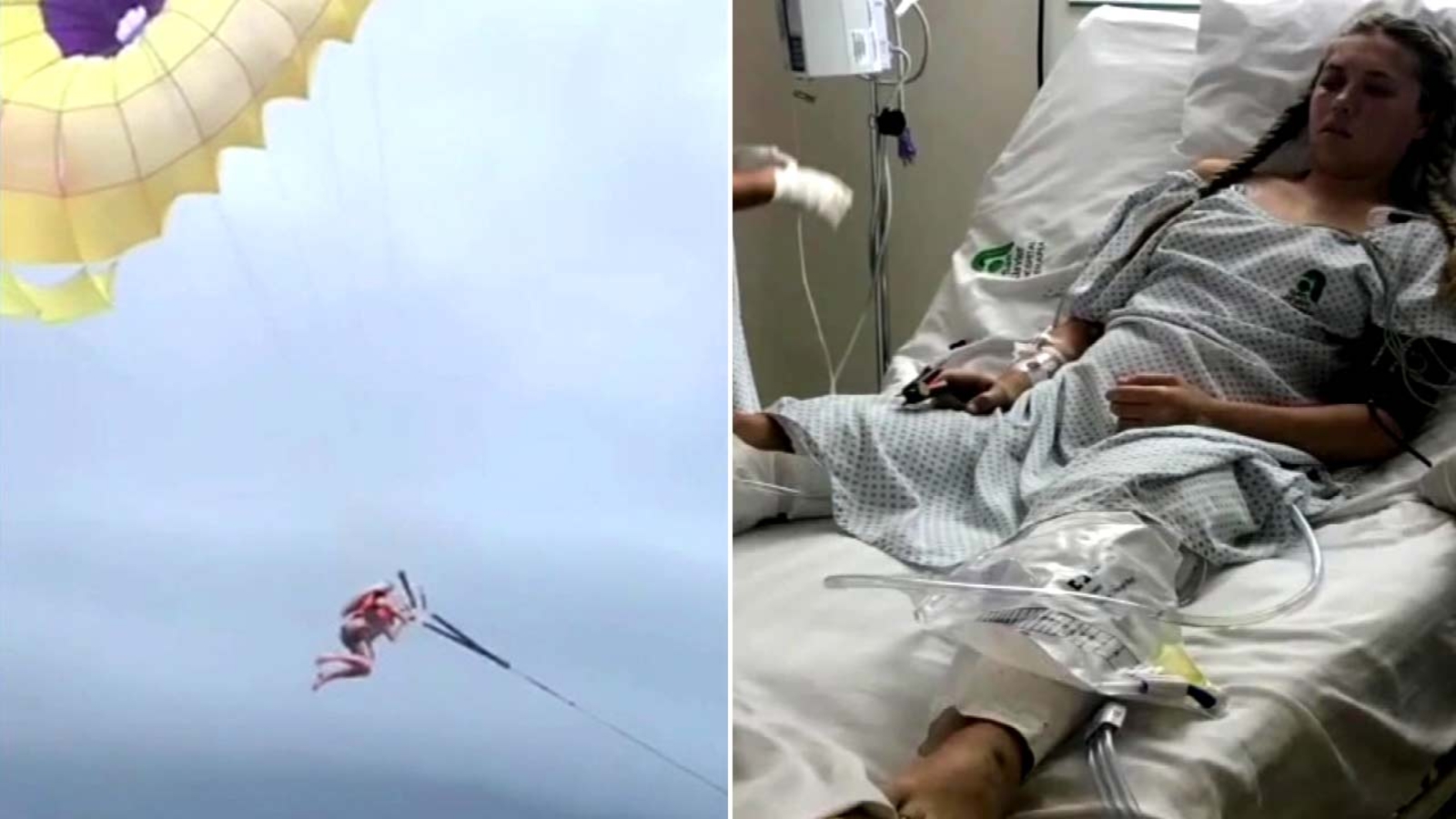 VIDEO SoCal woman suffers traumatic injuries after parasailing rope