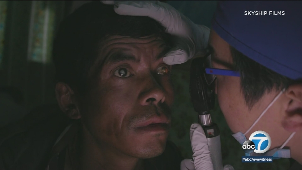 OC ophthalmologist performs cataract surgeries in Nepal