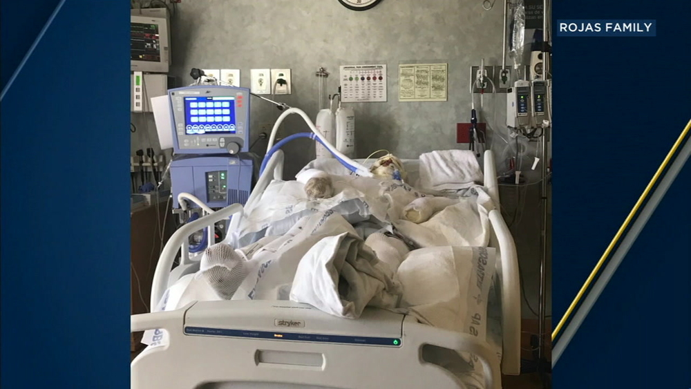 Santa Ana man remains in critical condition after arson fire