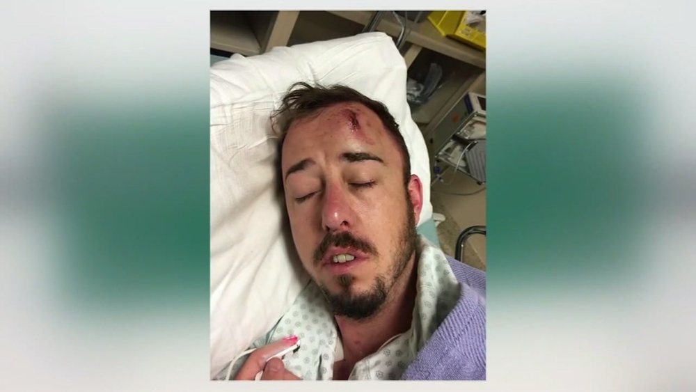 Man attacked outside of Montrose bar after being wrongly accused of exposing himself to a woman, HPD says