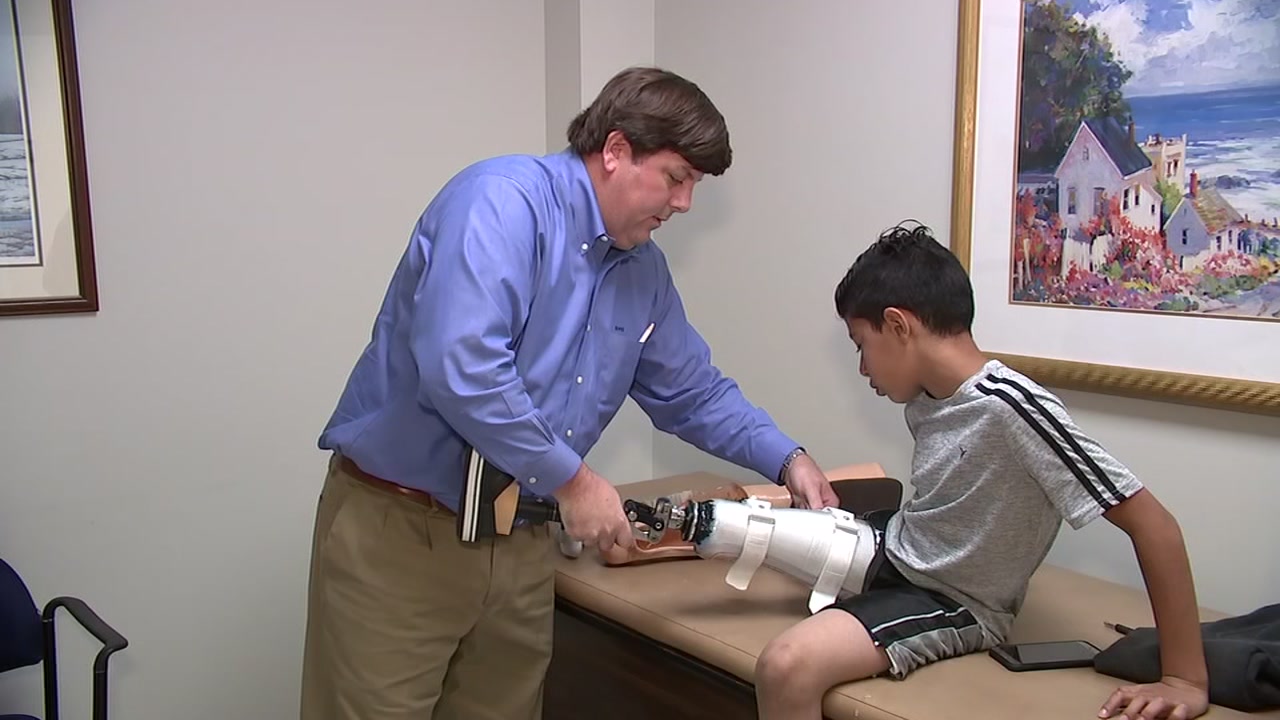 Child travels more than 6,000 miles to get fitted for prosthetic leg