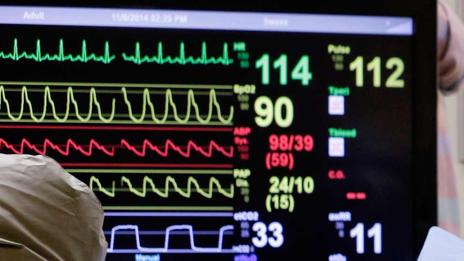 Florida woman survives 45 minutes with no pulse ABC13 Houston