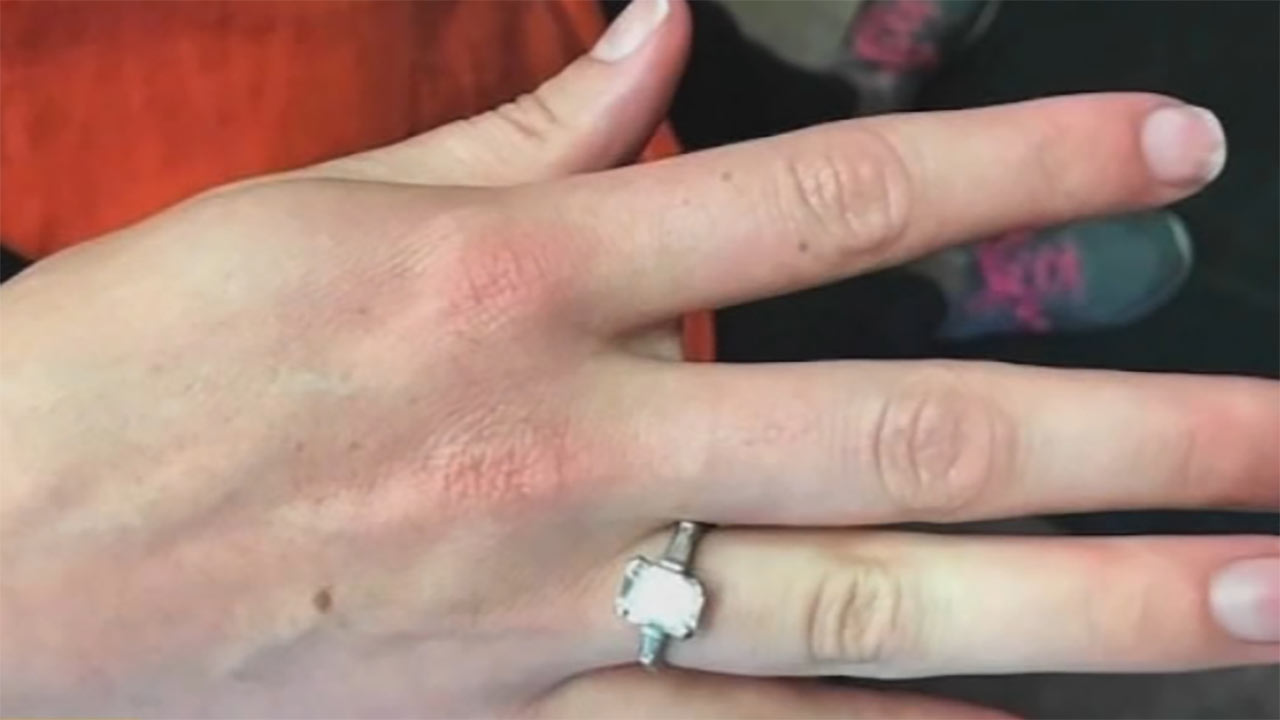 $30K ring accidentally thrown out, found at dump in minutes
