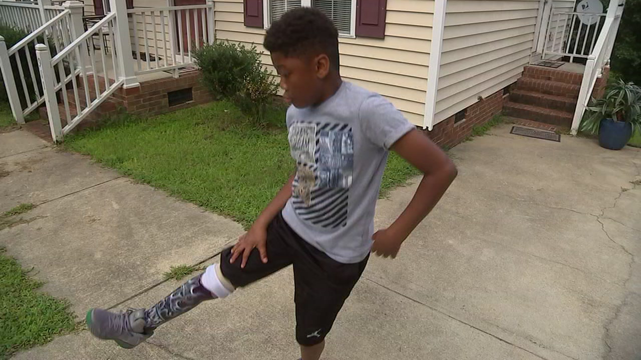 Star of "Black Panther" prosthetic video aims to inspire others