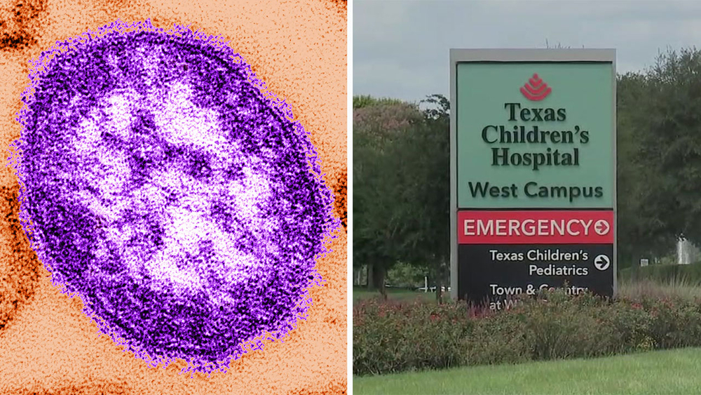 Boy diagnosed with Houston's 1st case of measles since 2013