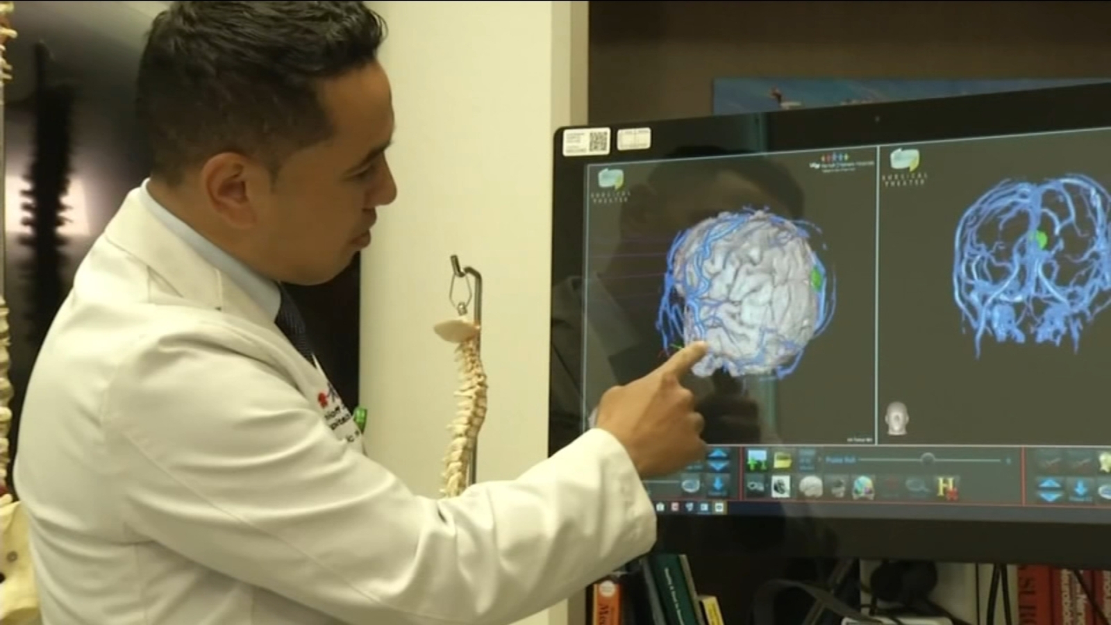 Virtual Reality Neurosurgery ABC30 Fresno