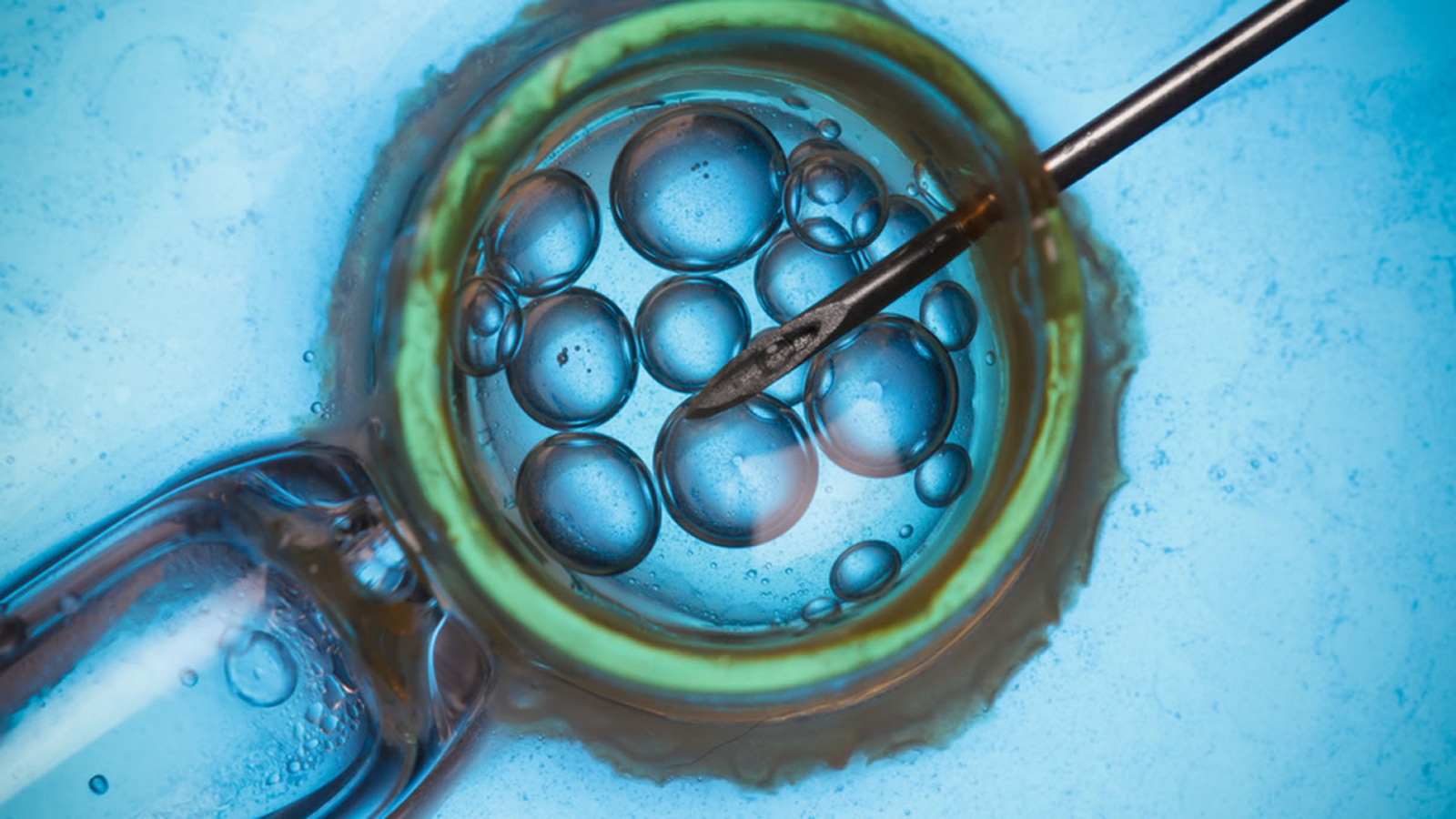 San Francisco, Cleveland fertility clinics experience rare malfunction