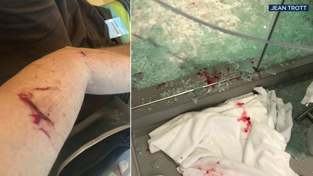 Raleigh woman injured when shower door explodes