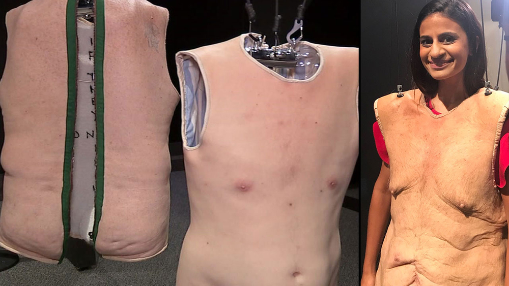 Step inside someone else's skin at the Health Museum