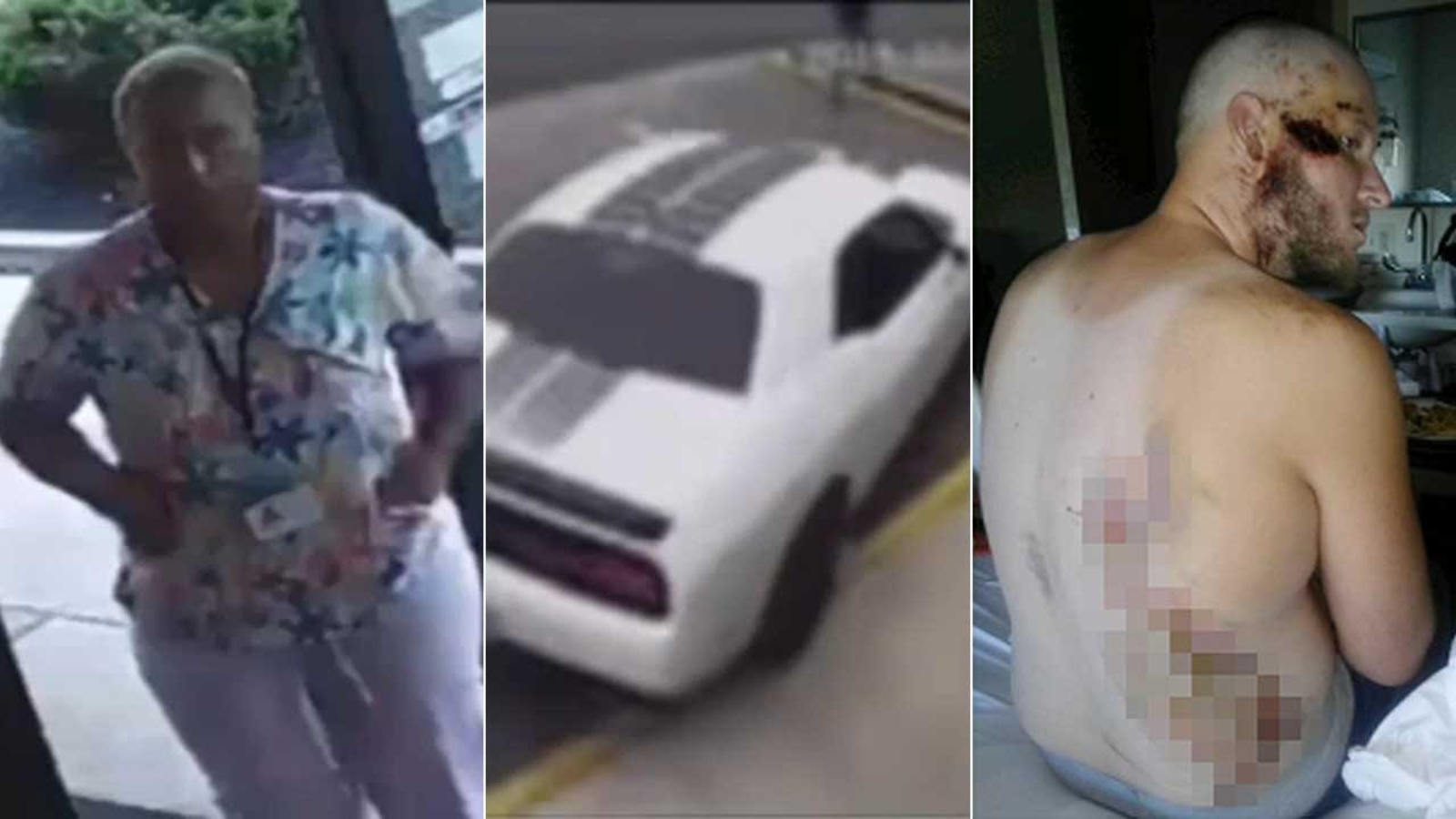 Police: Woman wanted after driving over man outside Dunkin' Donuts in ...