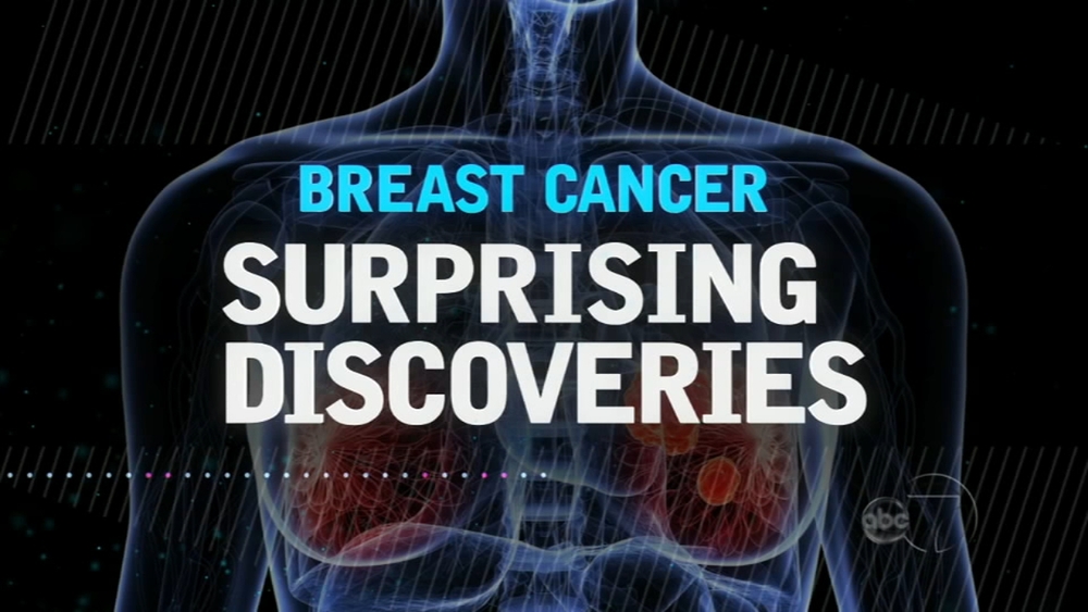 Breast Cancer: Surprising Discoveries- Part 3