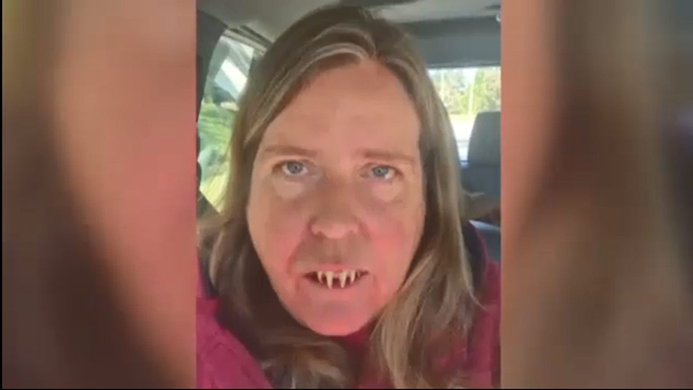 Woman with Zombie teeth stuck