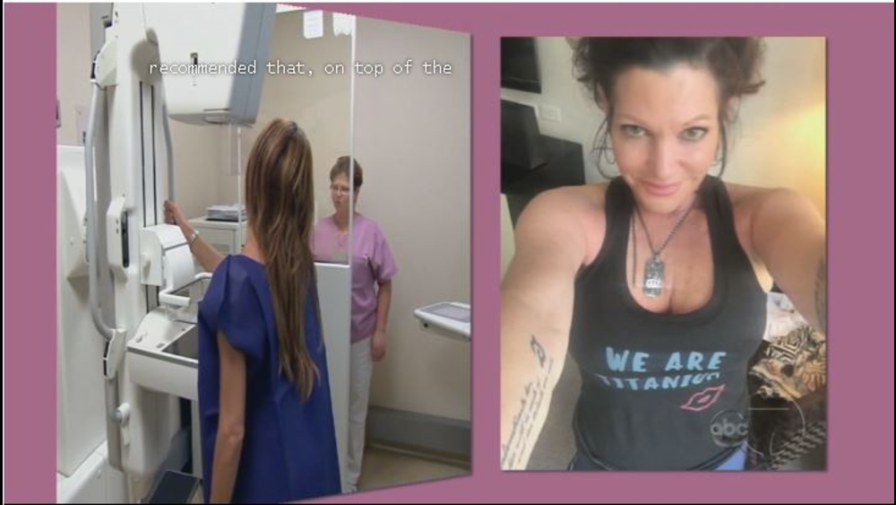 Breast Cancer: Surprising Discoveries - part 2