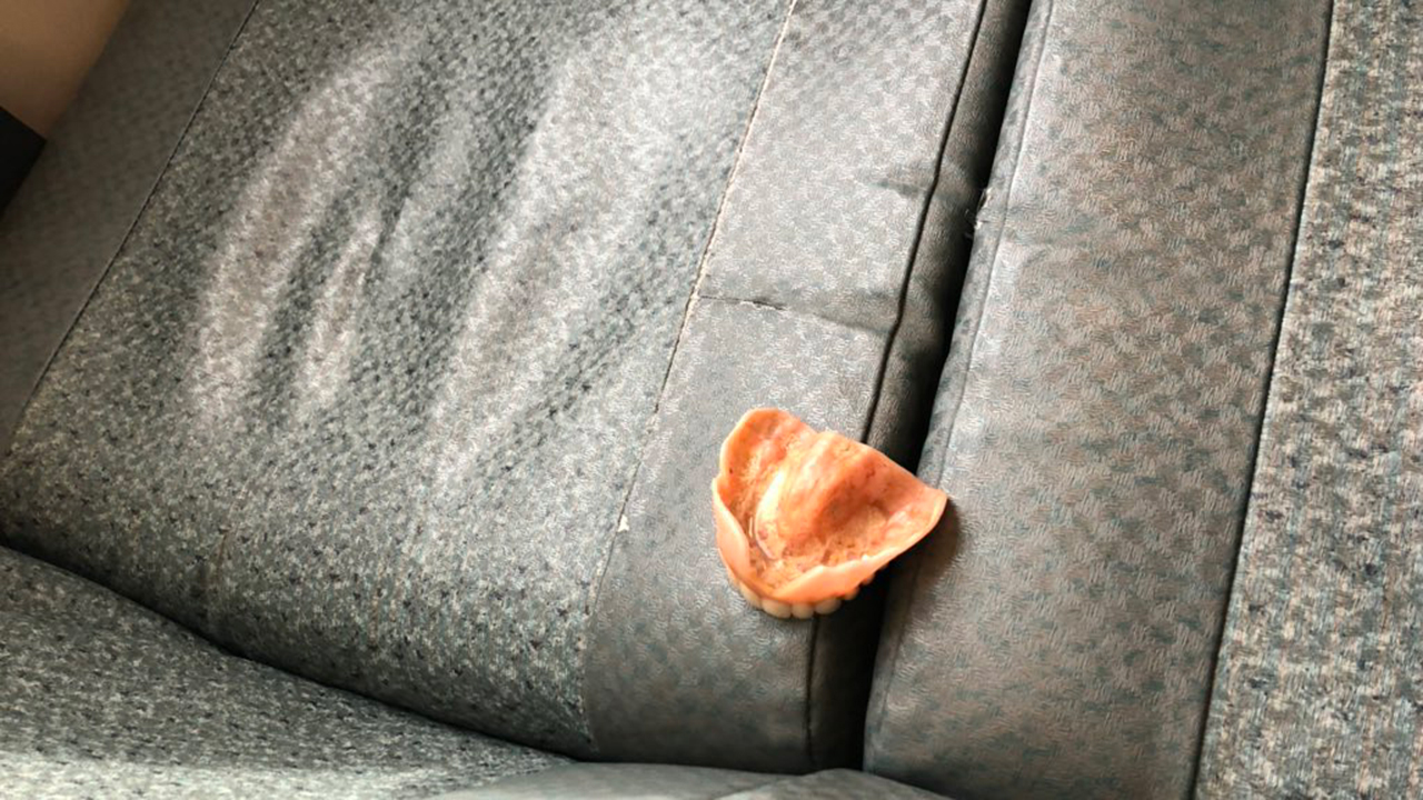 Commuter finds dentures left in seat on BART train