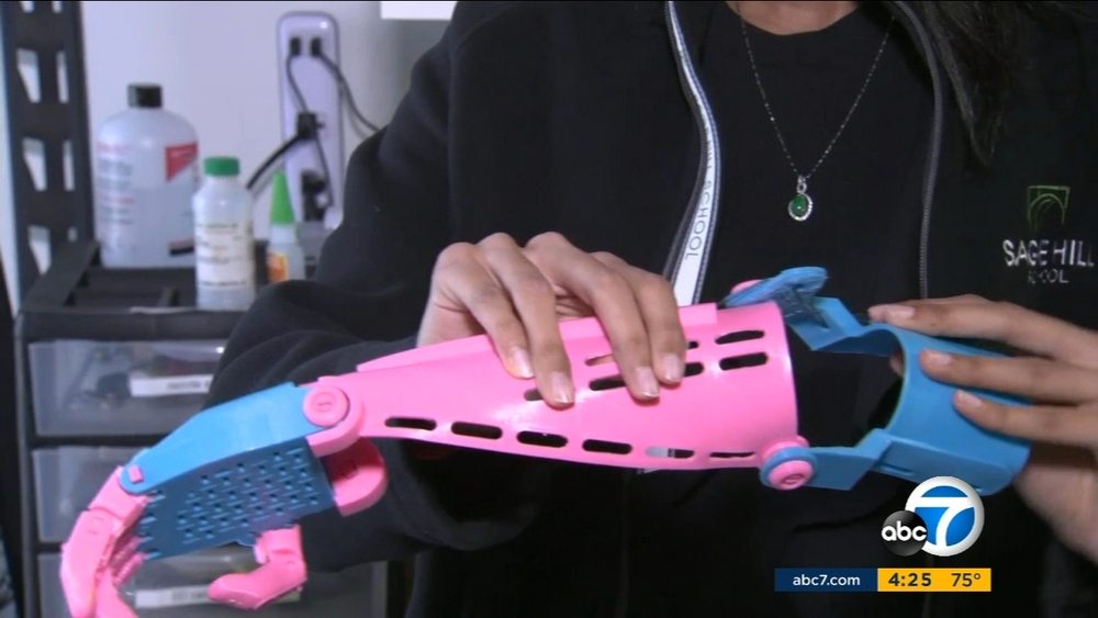 Cool Kid Karishma Raghuram builds prosthetic limbs