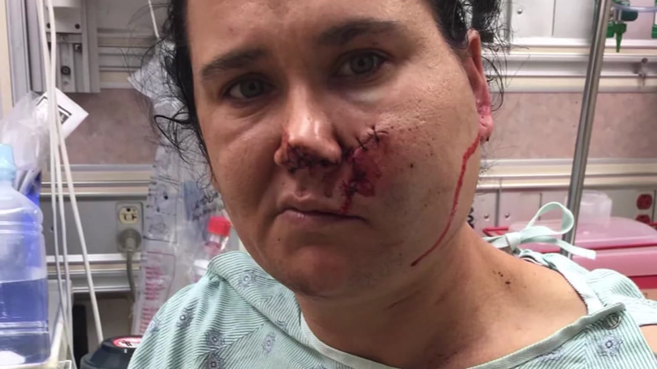 Man arrested for shooting woman in face with crossbow