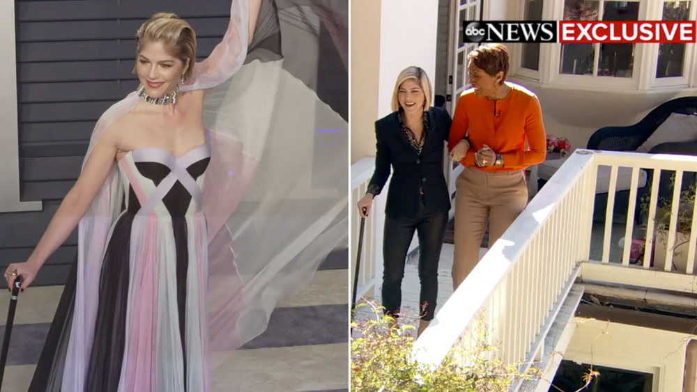 Selma Blair appears on 'GMA' to show how MS flare-up looks