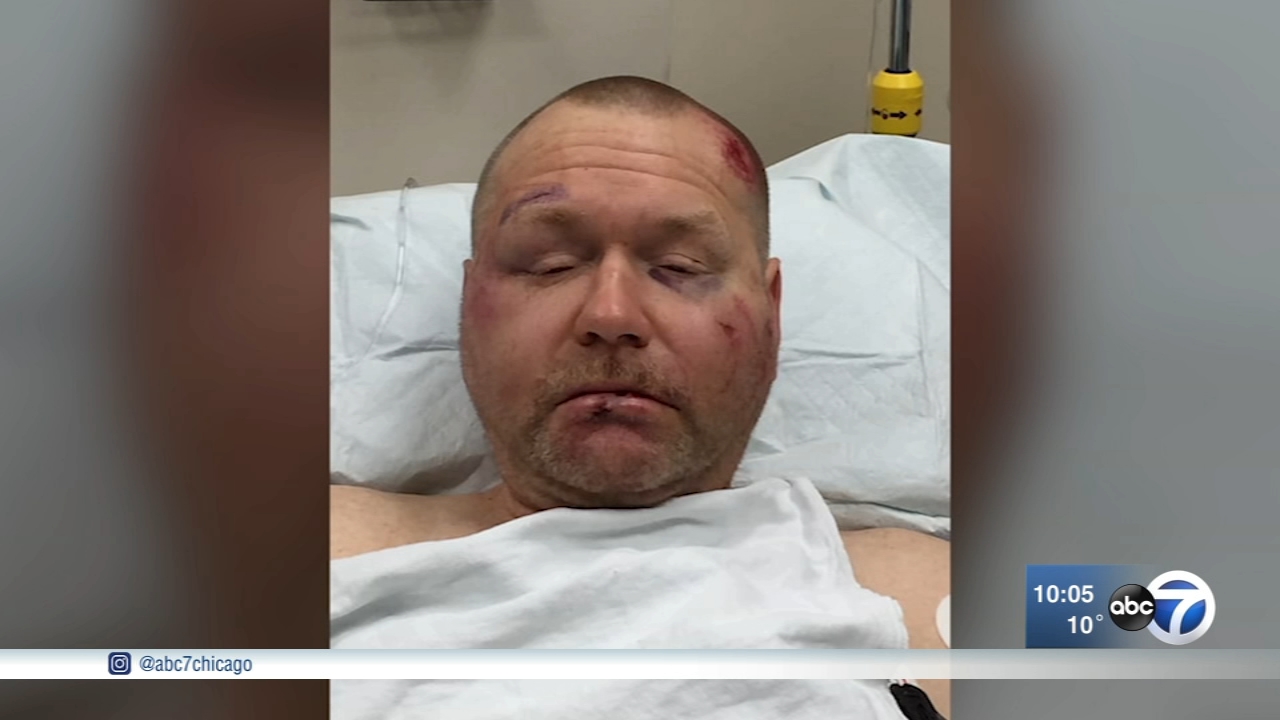 Man beaten in apparent road rage incident in Plano