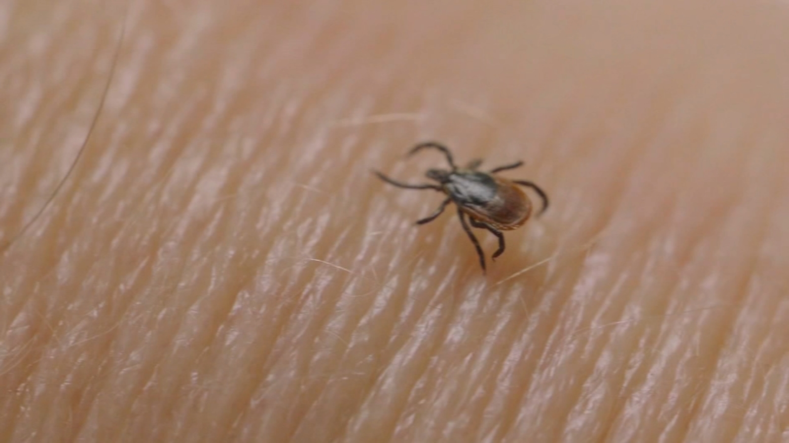 Lyme disease: Pennsylvania to conduct 5-year study of ticks and the